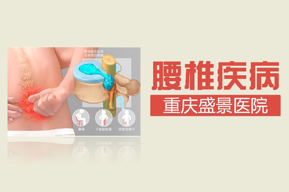 腰椎间盘突出的症状是什么 ?