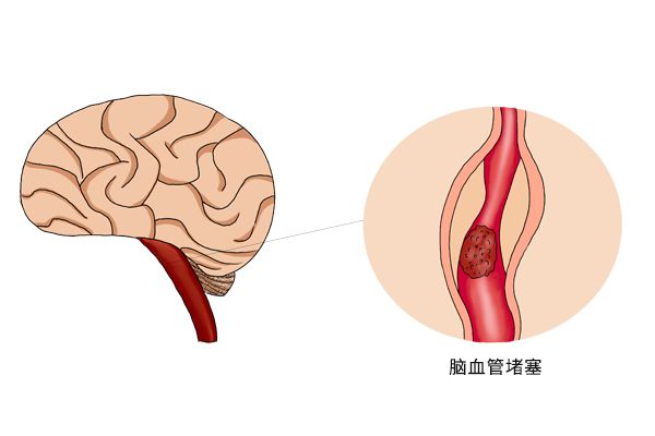 下载 (4).jpg